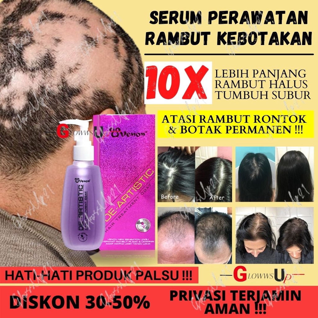 SERUM PENUMBUH RAMBUT BOTAK VENON UNGU SERUM RAMBUT PERAWATAN RAMBUT - HAIR TREATMENT