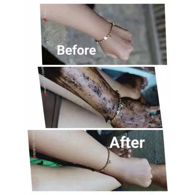 BEDDA LOTONG/LULUR TRADISIONAL KHAS BUGIS