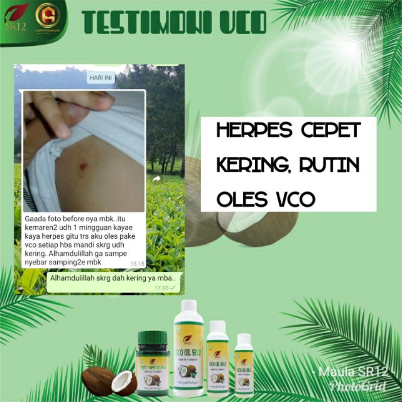 Vco kapsul SR12 Obat penyakit berat Diet paling ampuh Imun booster Minyak kelapa Menaikkan dan Menurunkan Berat Badan Menjaga Daya Tahan Tubuh Melancarkan Persalinan Menyembuhkan luka Berfungsi Sebagai Antivirus Cod BPOM Terlaris Termurah Original