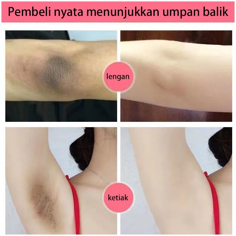 Cream Krim Pemutih selangkangan Pemutih ketiak Underarm Whitening cream Perawatan kewanitaan tubuh 60G Efektif memutihkan leher/tangan/kaki/miss v/Selangkangan/ ketiak/Aman dan tidak berbahaya