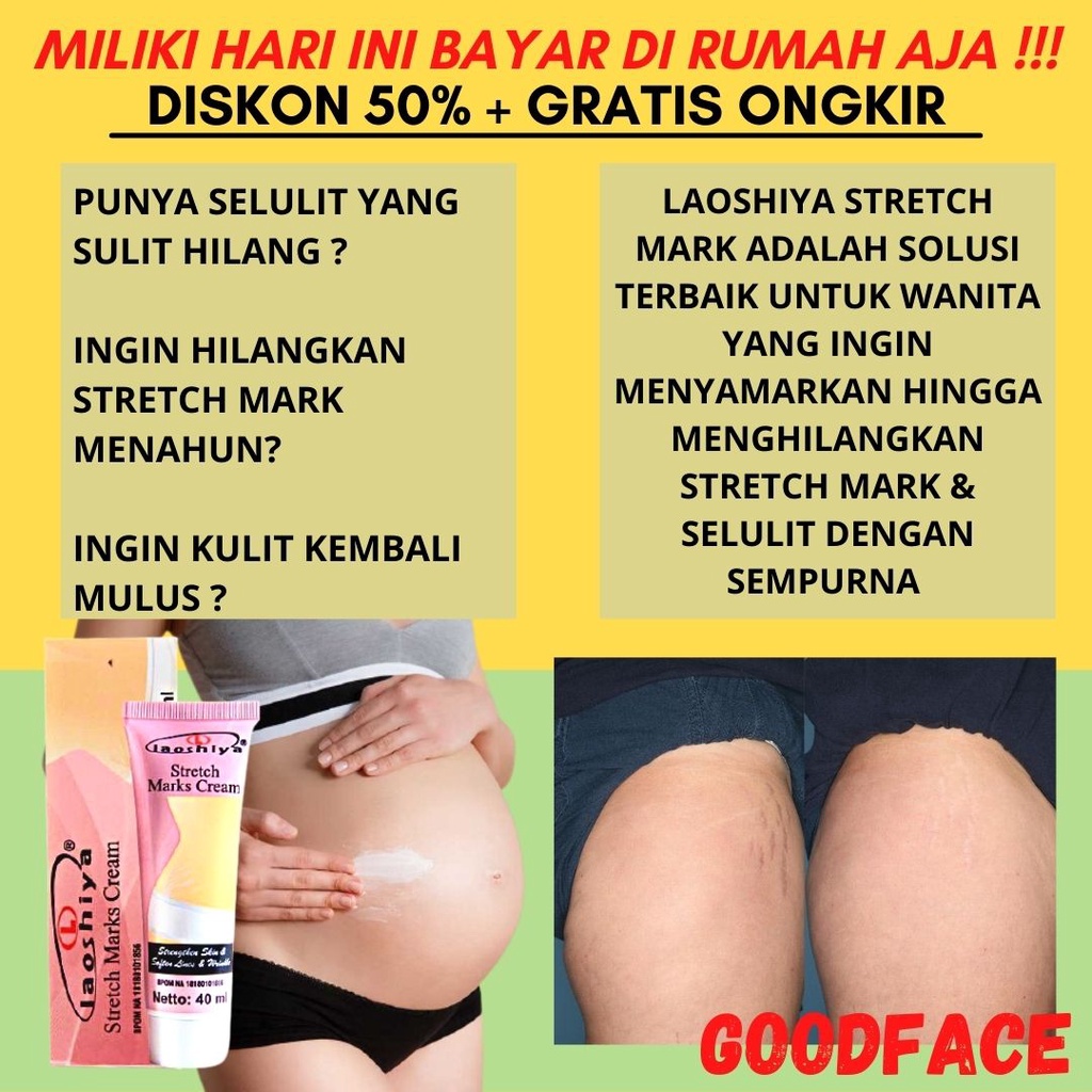 LAOSHIYA STRETCH MARKS CREAM PENGHILANG STRECHMARK ORIGINAL BPOM PENGHILANG BEKAS LUKA