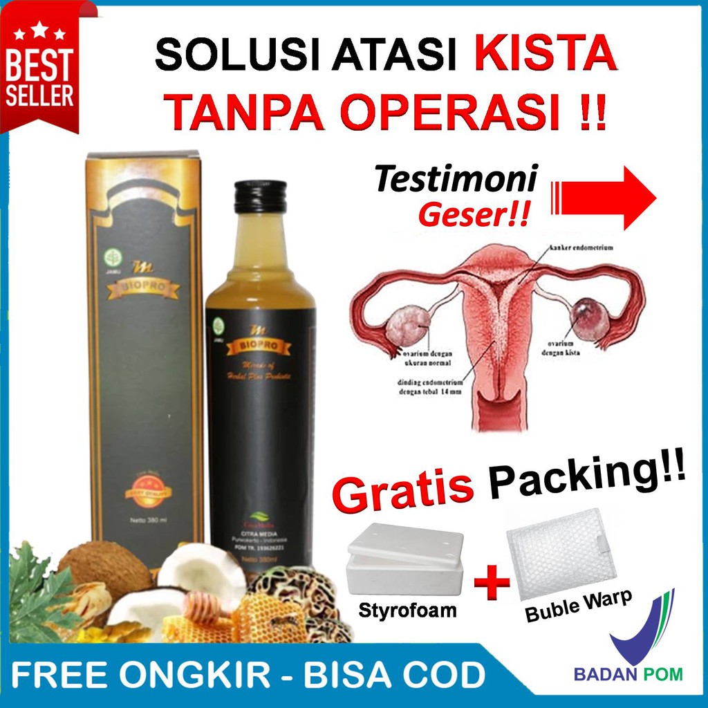 Obat Kista Ovarium Miom Kangker Kandungan Kista Mbiopro Keputihan Gatal Berlendir Kista Shopee Indonesia