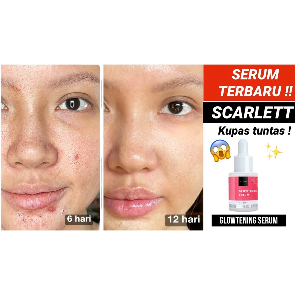 SERUM WAJAH SCARLET terlaris 3varian