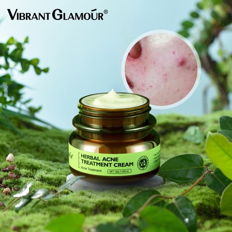 VIBRANT GLAMOUR Herbal Acne Treatment Cream / Acne Treatment Serum-Krim Perawatan Jerawat Tea Tree Oil penghilang jerawat Menghilangkan Pimple Dan Mengencangkan Pori-pori Kulit Berminyak Kulit Berjerawat