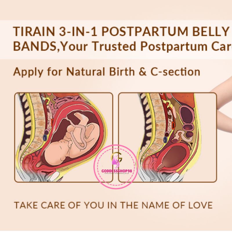 Korset Pelangsing Stagen Korset Melahirkan Postpartum 3in1 Pengecil Perut Buncit Pasca melahirkan