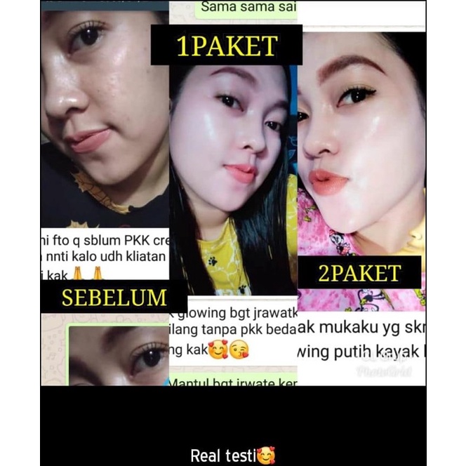 Raysa Clink Skincare RAYSA CLINK Cream malam raysa clink ( WAJIB KONSUL) 88 88