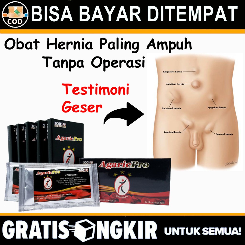 Obat Hernia Ampuh Alami Varikokel Dewasa - Hernia Herbal - Obat Agaricpro - Obat Hernia Terlaris