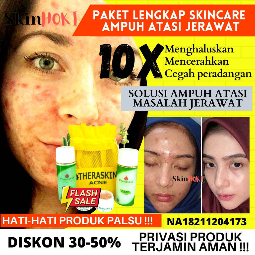 THERASKIN PAKET ACNE PENGHILANG JERAWAT PENCERAH WAJAH PAKET THERASKIN  ACNE PERAWATAN WAJAH BERJERAWAT ORIGINAL BPOM