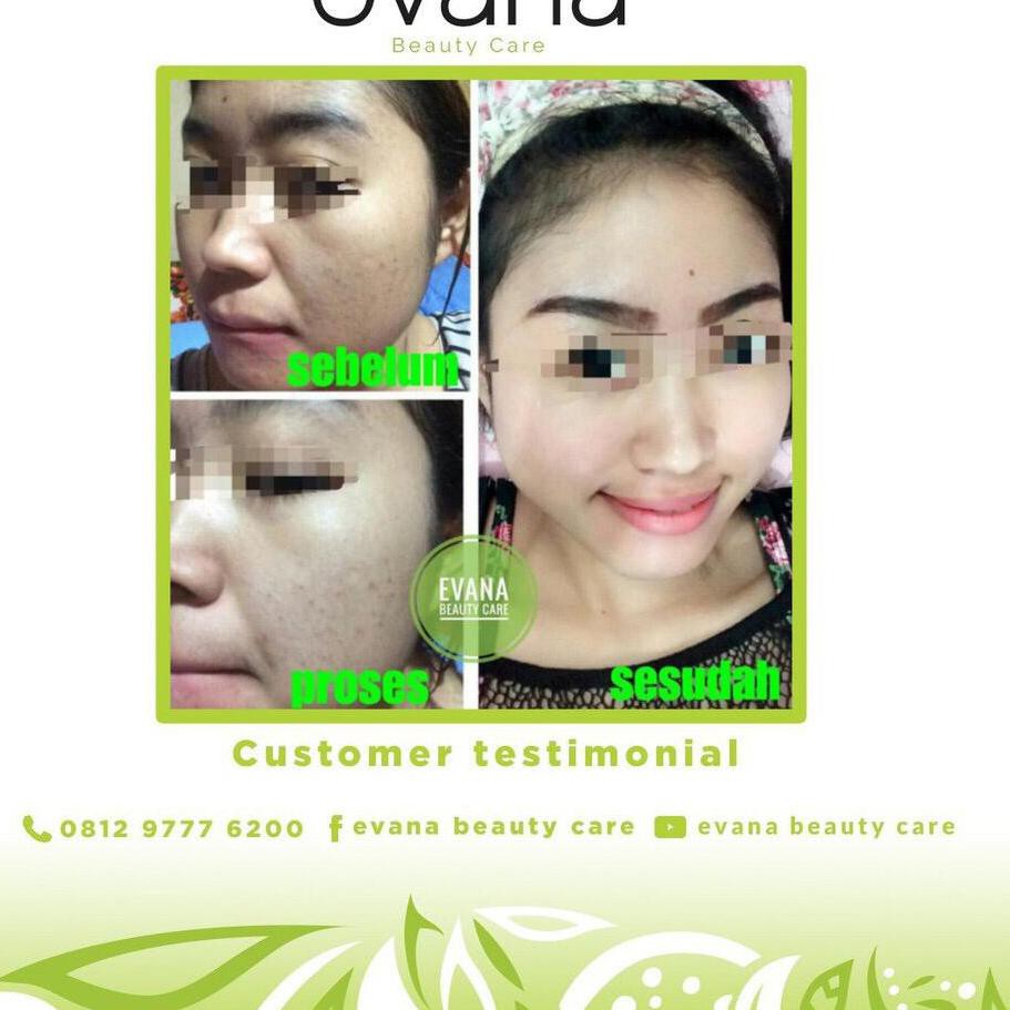 Viral   F WOW CREAM PEMUTIH WAJAH AMPUH DALAM 3 HARI Evana Paket Whitening II ≛