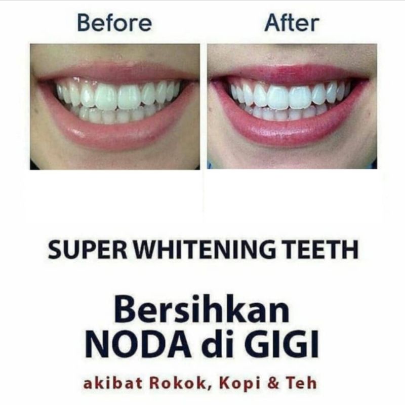 Super Whitening Teeth