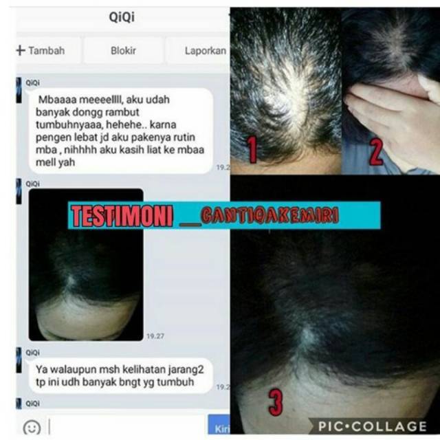 PAKET CANTIQA KEMIRI Penumbuh Rambut Botak Pitak Nonong Herbal Alami