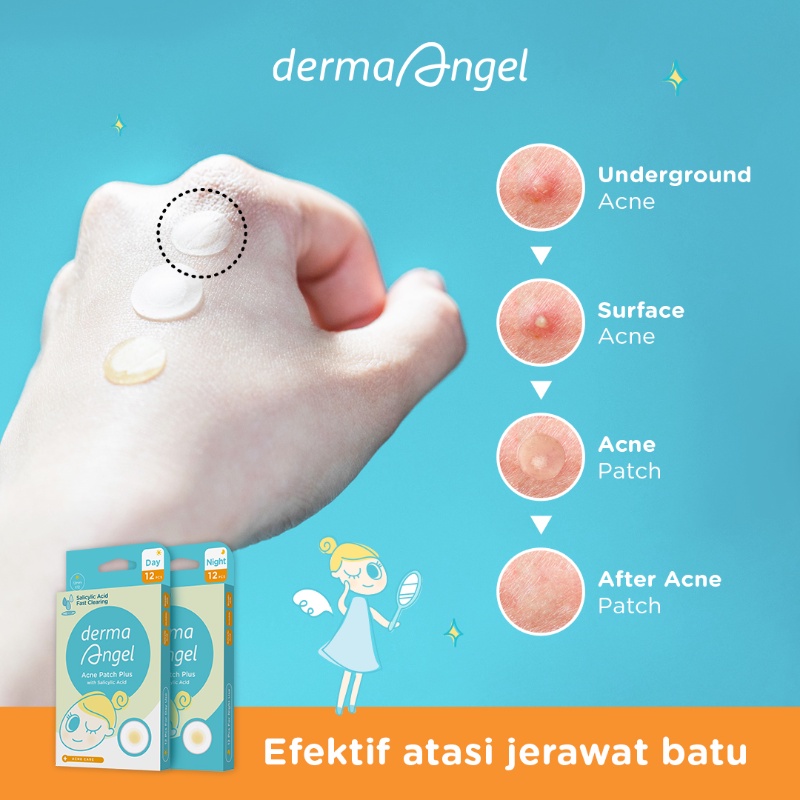 Image of Derma Angel Acne Patch Plus with Salicylic Acid Night: Isi 12 Patch | Plester Jerawat Batu | Plester Jerawat Transparan | Acne Skincare #3