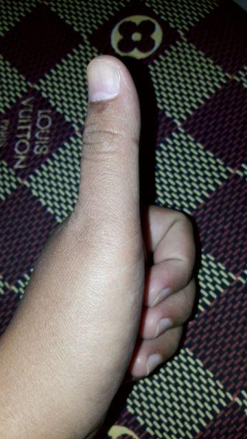 Vape Pembasmi Nyamuk 30hari One Push