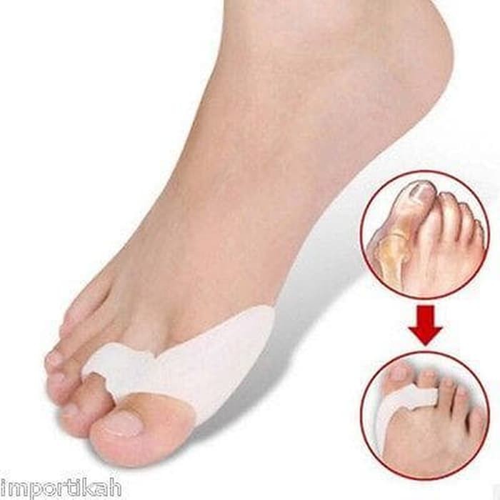 ALAT TERAPI KAKI JEMPOL KAKI HALLUX VALGUS BUNION PEMISAH KOREKTOR JARI KAKI JEMPOL