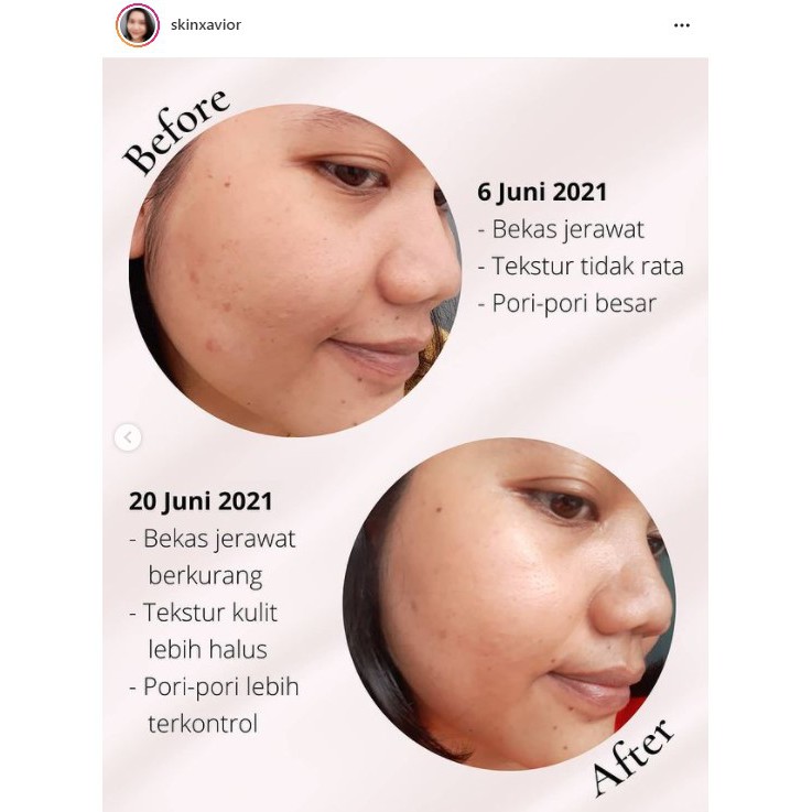 Retinol Renewal Serum Pratista : Serum Retinol Untuk Pemula