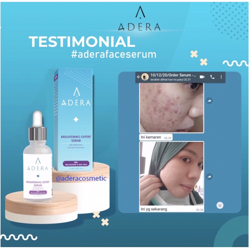 Adera Serum Wajah Glowing Putih Bersih Bebas Jerawat Kusam Flek Bintik Hitam Terdaftar BPOM