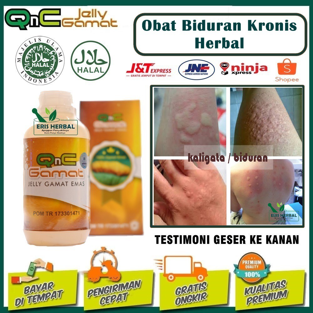 Obat Biduran Kronis Herbal Solusi Kulit Gatal Bentol Bentol Terampuh Shopee Indonesia