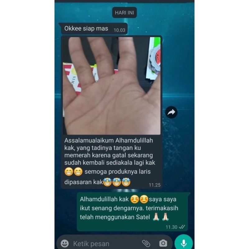 SATEL GTL ORIGINAL 100% Salep Gatel Ampuh Atasi Panu Kadas Kurap Koreng Gatal Jerawat-2