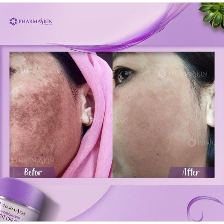 Pharmaskin Whitening Flek Full Treatment Paket Lengkap Perawatan Wajah Putih Glowing resmi BPOM-6