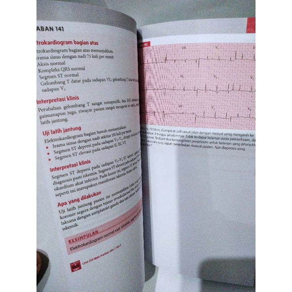 (ORIGINAL) BUKU 150 KASUS EKG EDISI INDONESIA TERBARU