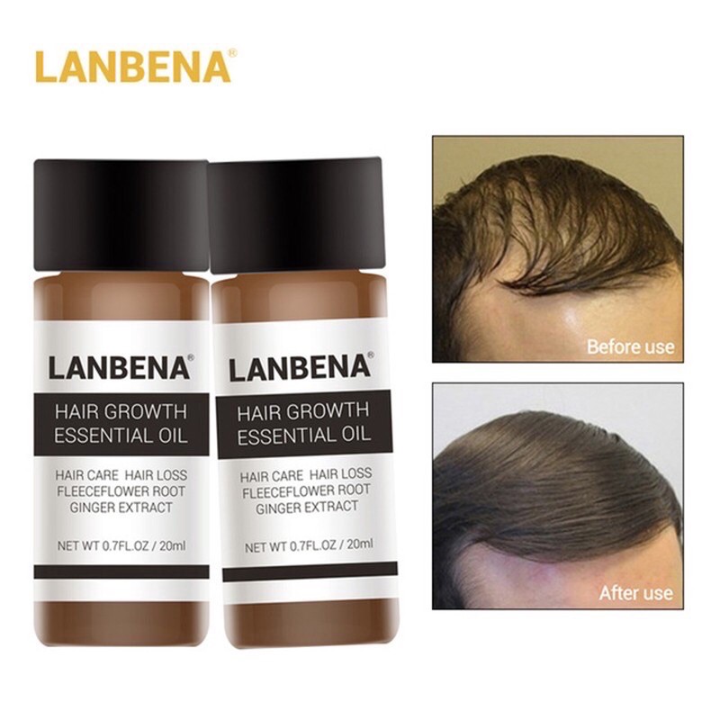 LANBENA serum penumbuh rambut herbal / lanbena hair growth serum