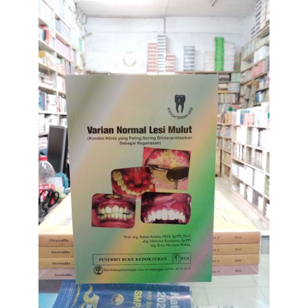 Varian Normal Lesi Mulut - Rahmi Amtha