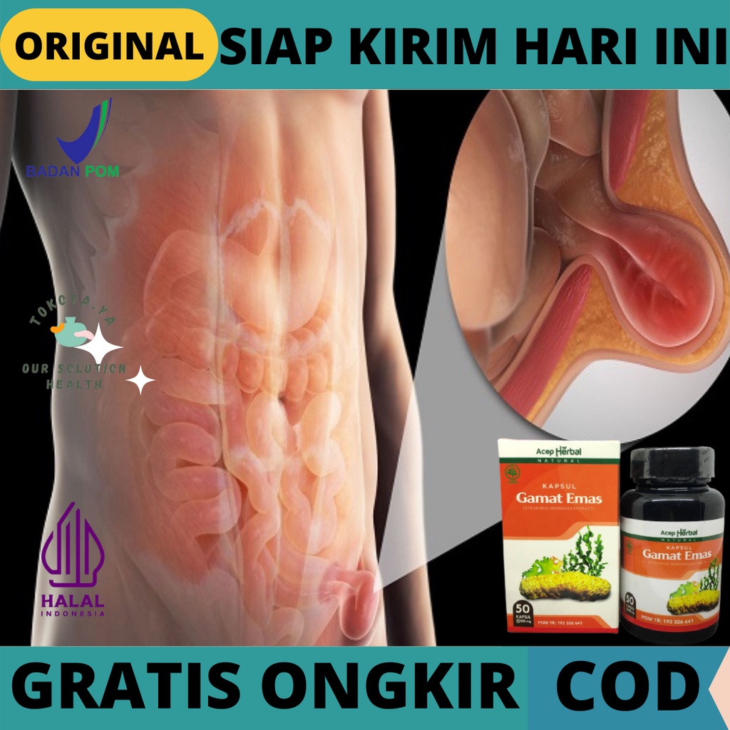 Obat Hernia Menyembuhkan Penyakit Hernia,  Obat Herbal pemulihan Hernia, Obat Herbal Mengobati Sakit