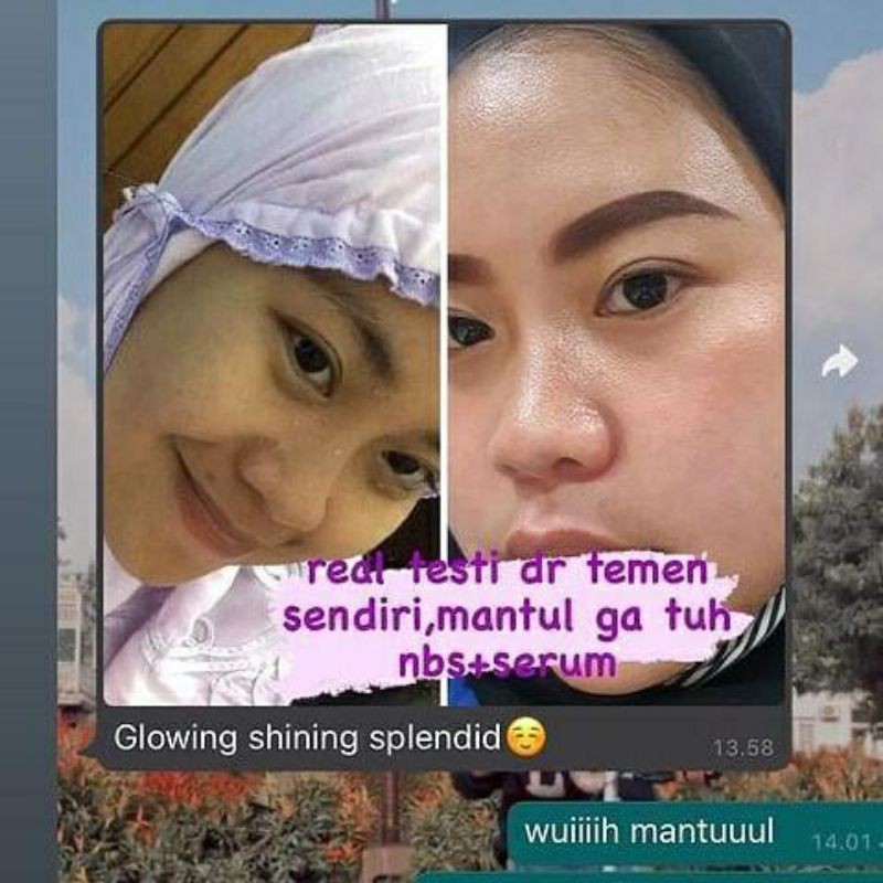 NBS SKINCARE ULTIMATE NEW-6