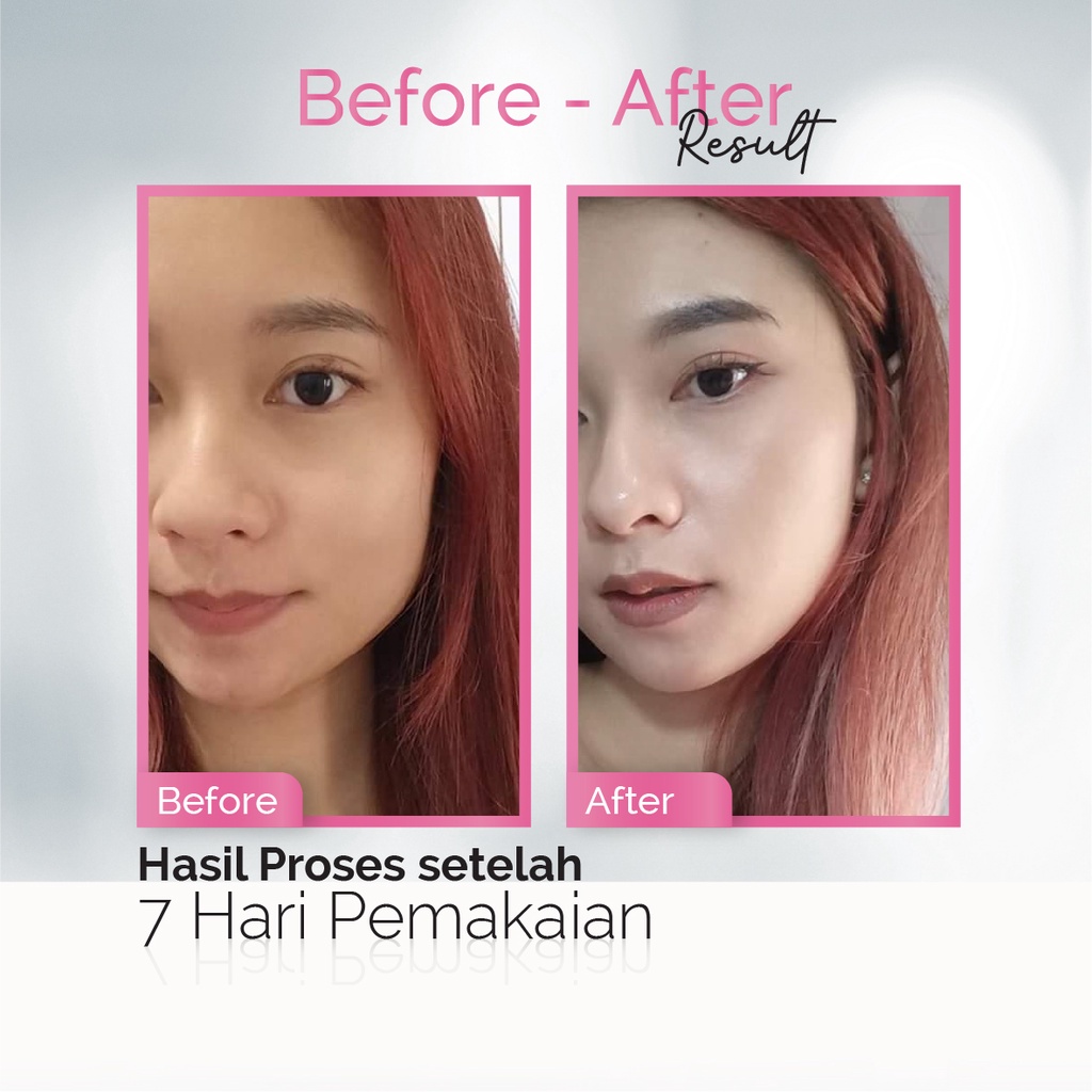 Hanasui Paket Skincare Flawless | Hanasui Paket Skincare Acne Treatment | Cream Pemutih Wajah / Skincare Wajah