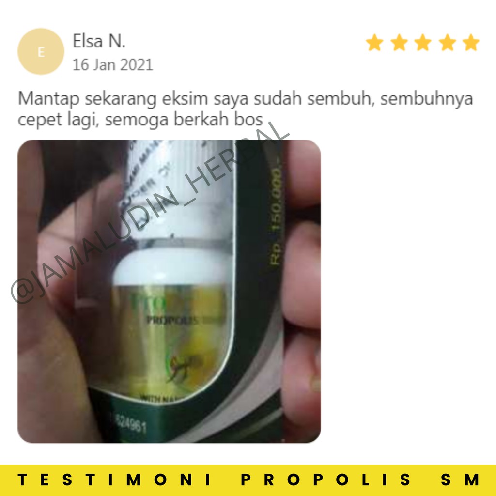 Obat Eksim Kering Basah Kering  Gatal Gatal Jamur Kulit Kepala Salep Eksim Scabies Obat Gatal Kudis Kurap Kutu Air Obat Gatel Selangkangan Berjamur Aman Balita Propolis SM Brazil Original 100% Asli-3