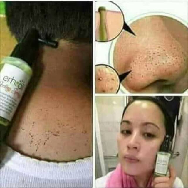 EARSHALI PEELING SPRAY NASA( PEELING)