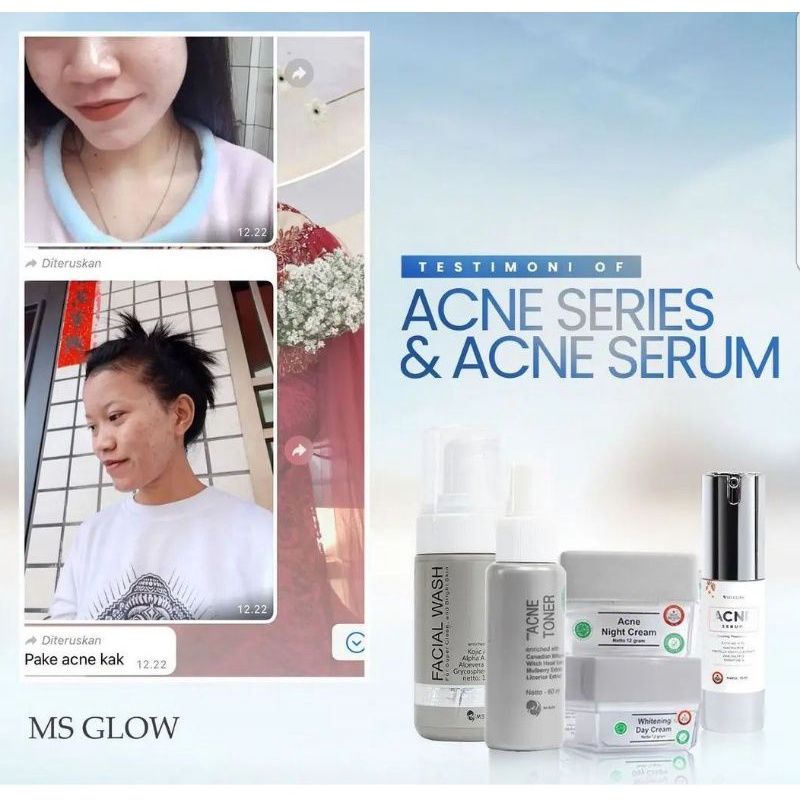 Paket Acne+serum acne 15 ml MS GLOW