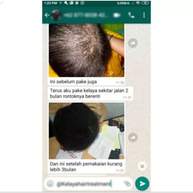 KELAYA SHAMPOO HAIR TREATMENT/PROMO BELI 2/SHAMPO ANTI RONTOK SHAMPOO RAMBUT RONTOK-6