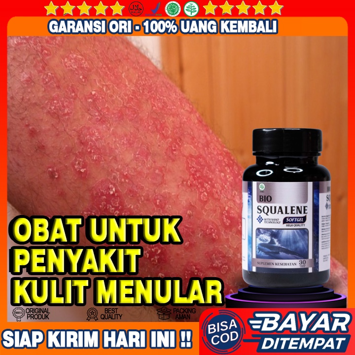Obat Penyakit Kulit Menular - Obat Penghilang Kulit Gatal Gatal - Obat Kudis Scabies - Obat Eksim - 