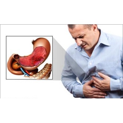 Cara Mengobati Asam Lambung Agaricpro Paling Ampuh