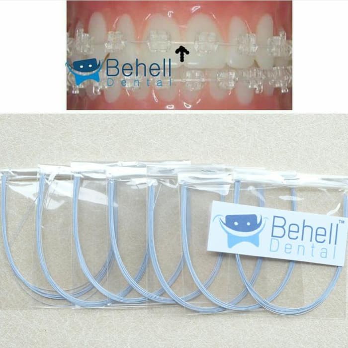 Behel Gigi - Karet Behel - Sikat Gigi Behel Kawat Warna Putih Untuk Behel Permanen Satuan Produk