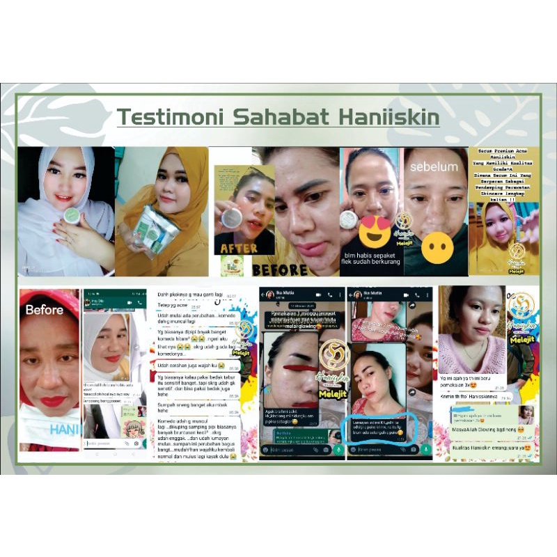 FREE GIFT !!! Haniiskin Skincare 1paket+Serum Premium !! 100% Original.-4