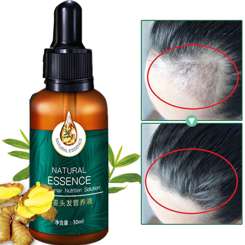 Minyak esensial perawatan rambut/ Anti-Hair Loss Serum/ Natural Essence Ginger Hair Tonic/ Toner Rambut Ekstrak Sari Jahe 30 ML