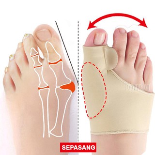 Image of Alat Terapi Sleeve Korektor Tulang Jempol Bunion Bengkok Hallux Valgus Orthotics Sepasang