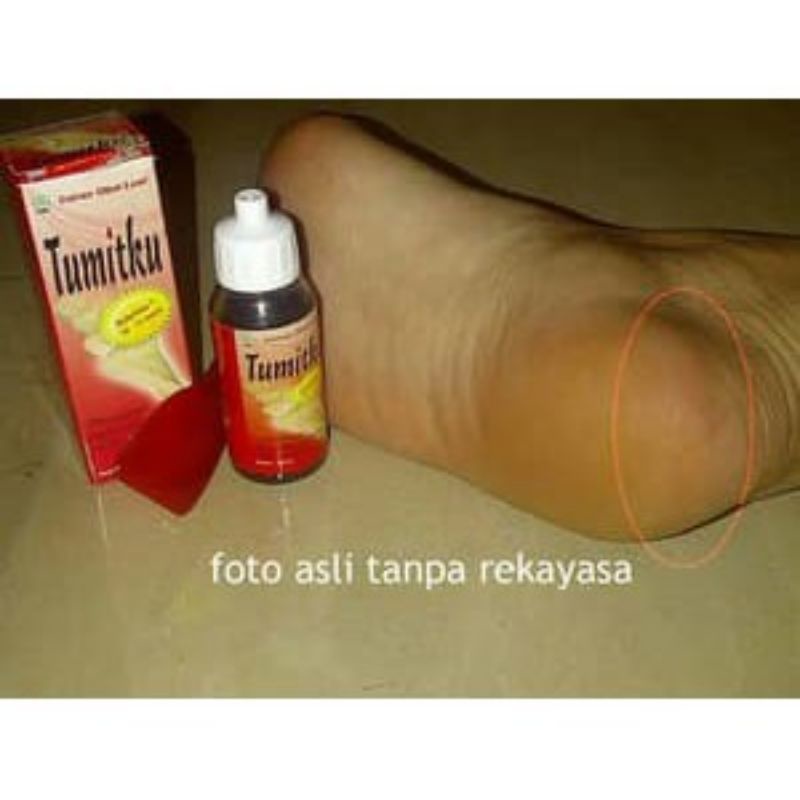 Bisa COD - tumitku obat kaki pecah original 30ml BPOM Solusi Kaki Pecah kapalan bisa cod