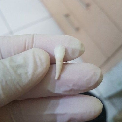 [SULUNG/SUSU] GIGI ASLI MANUSIA SERI / INCISIVUS SUSU / SULUNG / ANAK UNTUK PRAKTIKUM