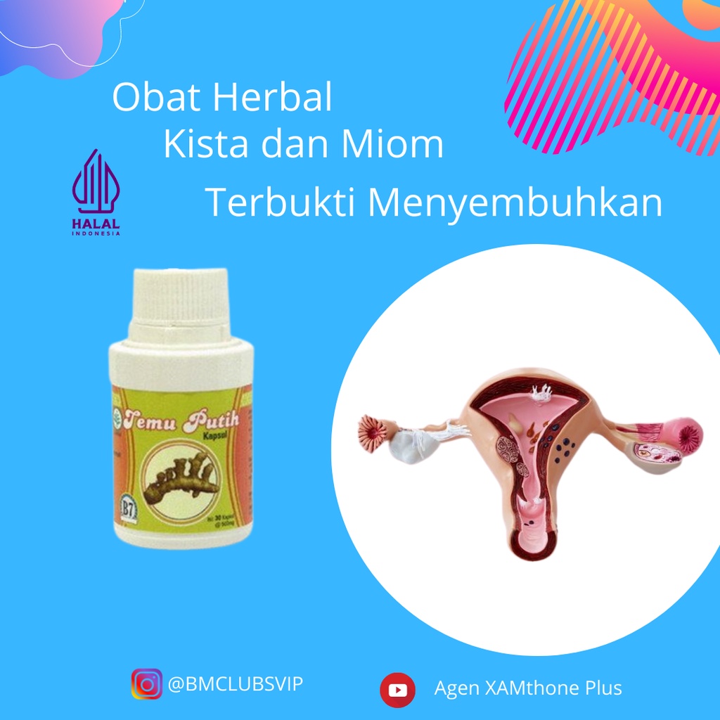 Obat Kista Miom