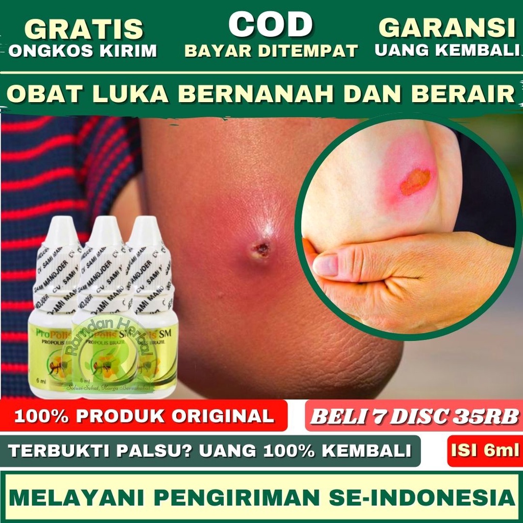 Obat Luka Bernanah Dan Berair Infeksi Luka Pengering Luka Penghilang Bekas Luka Propolis SM HALAL BP