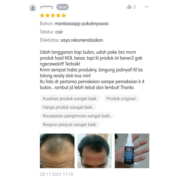 Bio Finmix Minoxidil Penumbuh Rambut Dan Mengatasai Rambut Rontok Hingga Rambut Botak-2