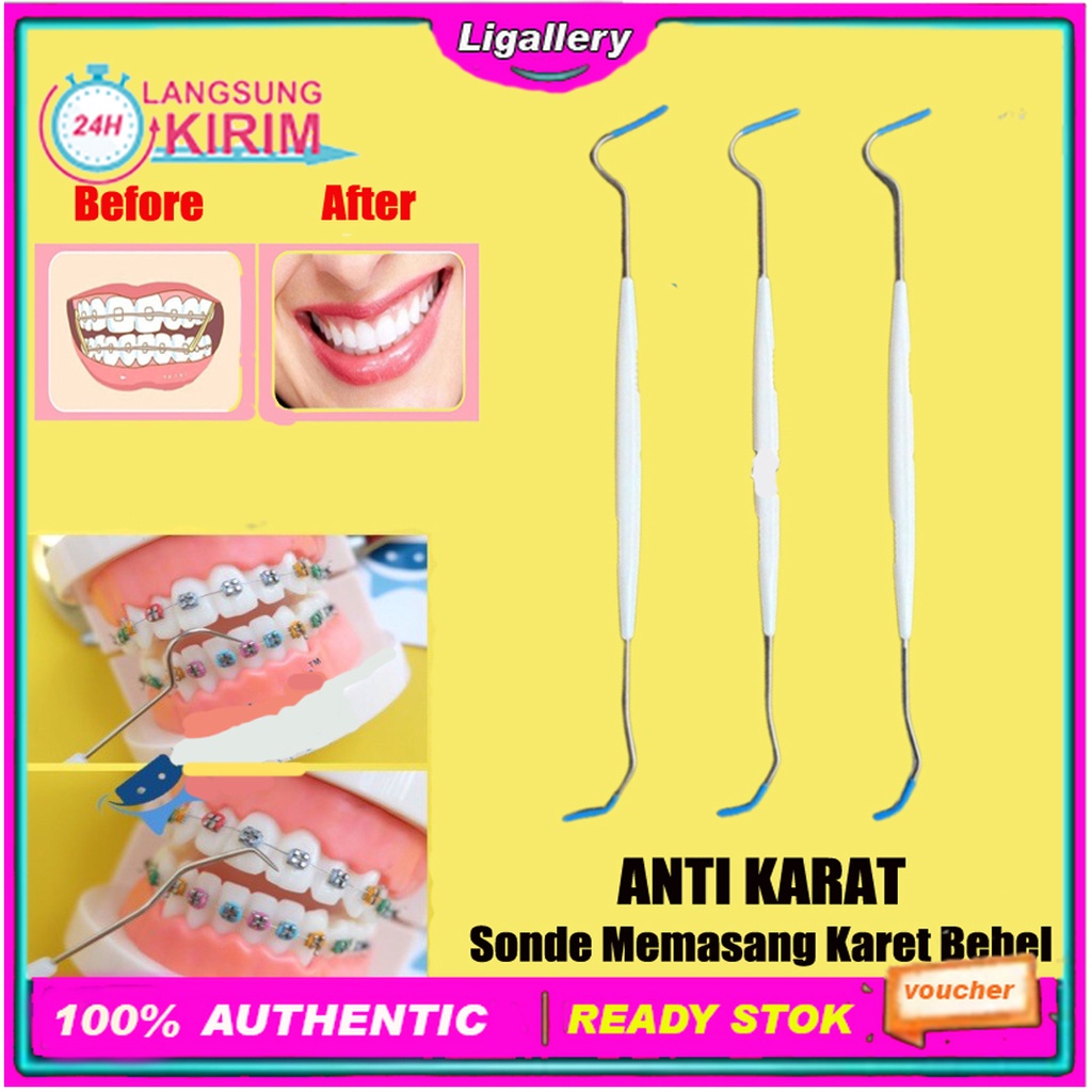 [BISA COD] Alat Buat Melepas Memasang Karet Behel Alat Pasang Karet Behel Serbaguna
