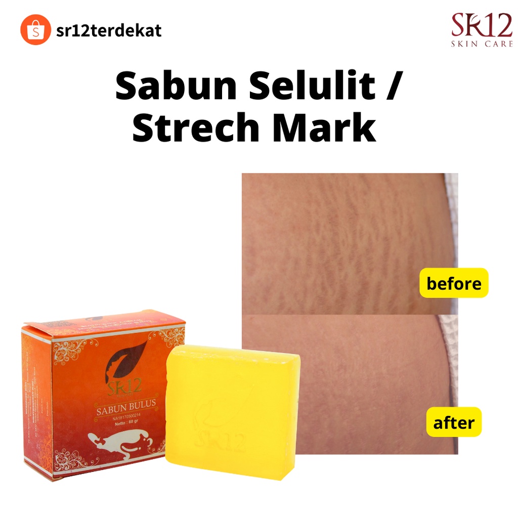 Sabun Selulit Sr12 / Sabun Stretch Mark Sr12