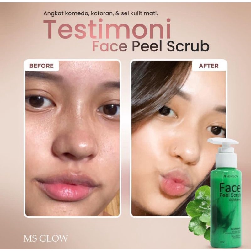 Face Peel Scrub Ms Glow