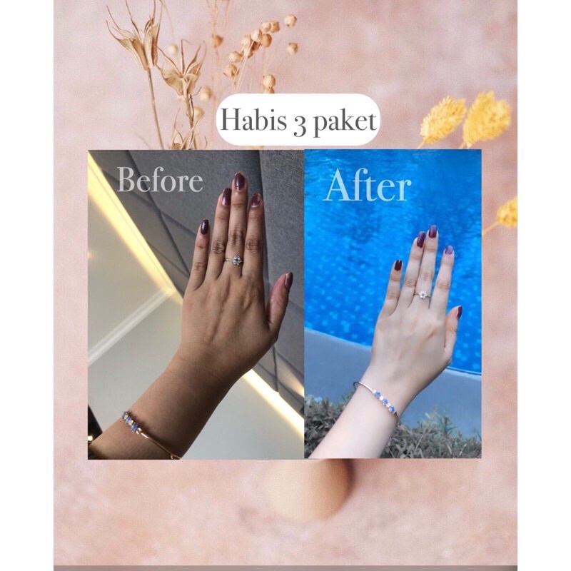 TERBATAS‼️ PAKET EXCLUSIVE LOTION PEMUTIH BADAN GREENTEA DOSTING BPOM // KEMASAN BARU zarv.skincare