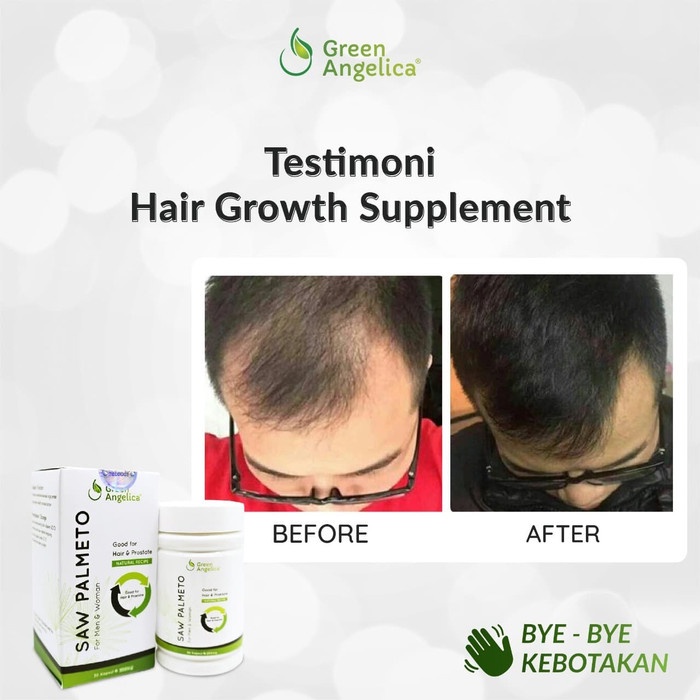 RAMBUT-VITAMIN-SUPLEMEN- SAW PALMETTO GREEN ANGELICA SUPLEMEN PERAWATAN RAMBUT MENCEGAH RONTOK