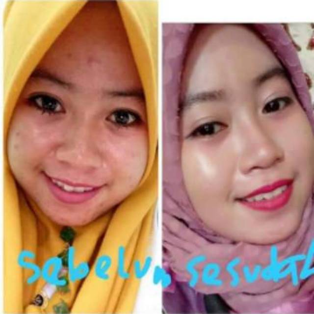 Nezzmg skincare ORI